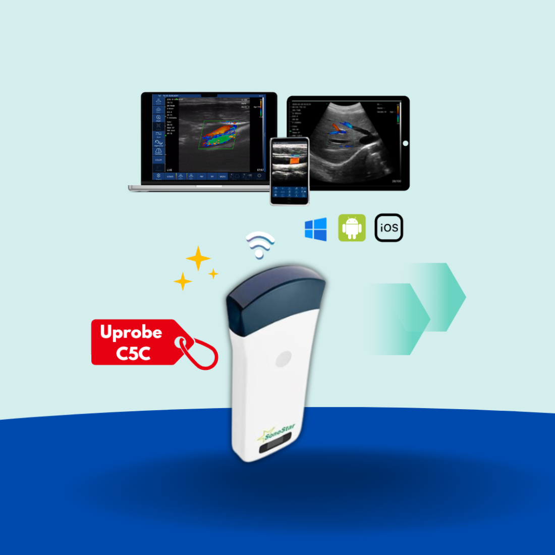 Đầu dò siêu âm Convex không dây