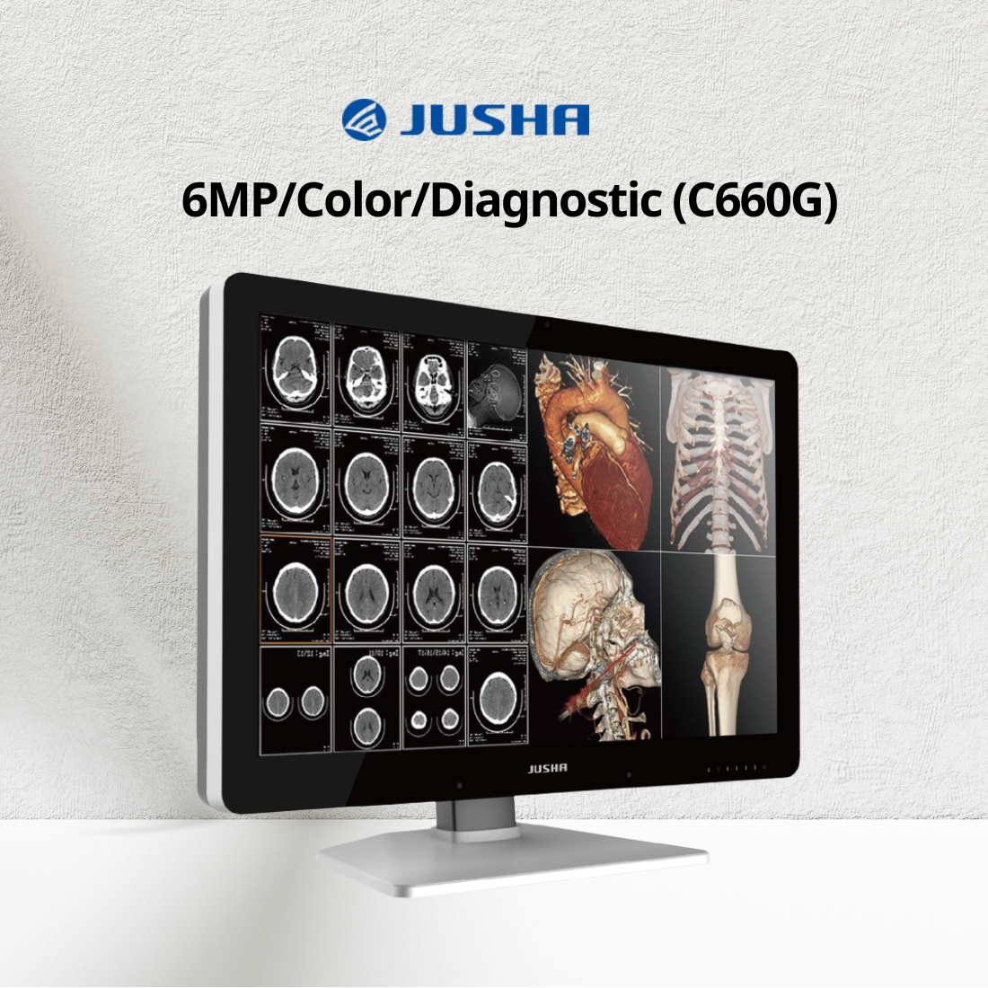 6MP Clolor Diagnostic Monitor